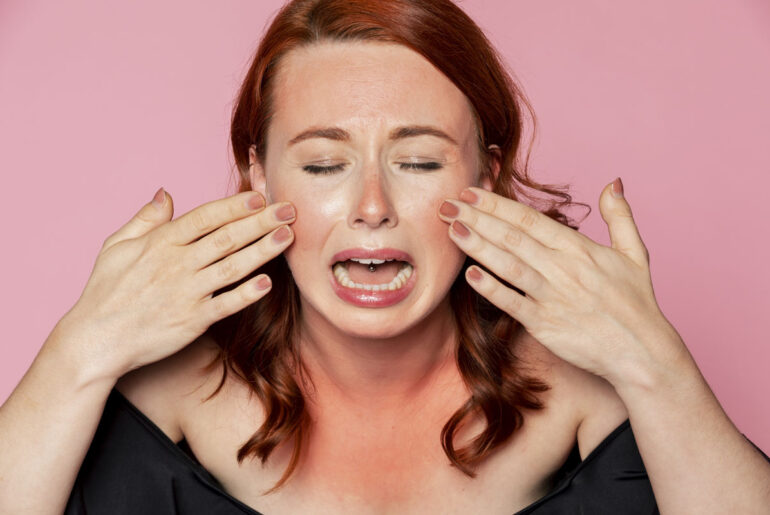 Woman crying over sunburn - She need to know how to treat sunburn